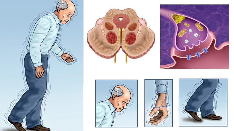 Illustration of an old man suffering from Parkingson's disease