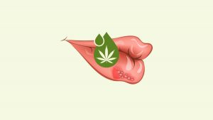 Illustration of cannabis treatment for a lip with herpes