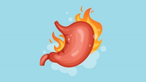 Illustration of Acid Reflux and GERD on blue background