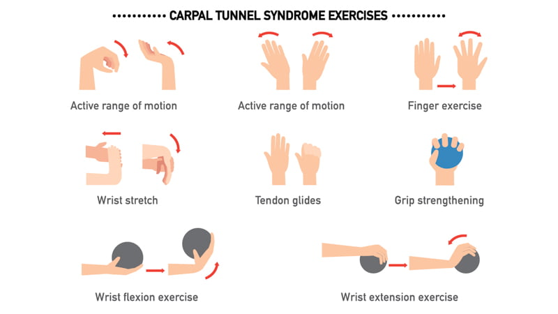Exercises for Carpal Tunnel Syndrome Illustration