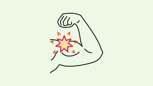 illustration of muscle spasm on the arm